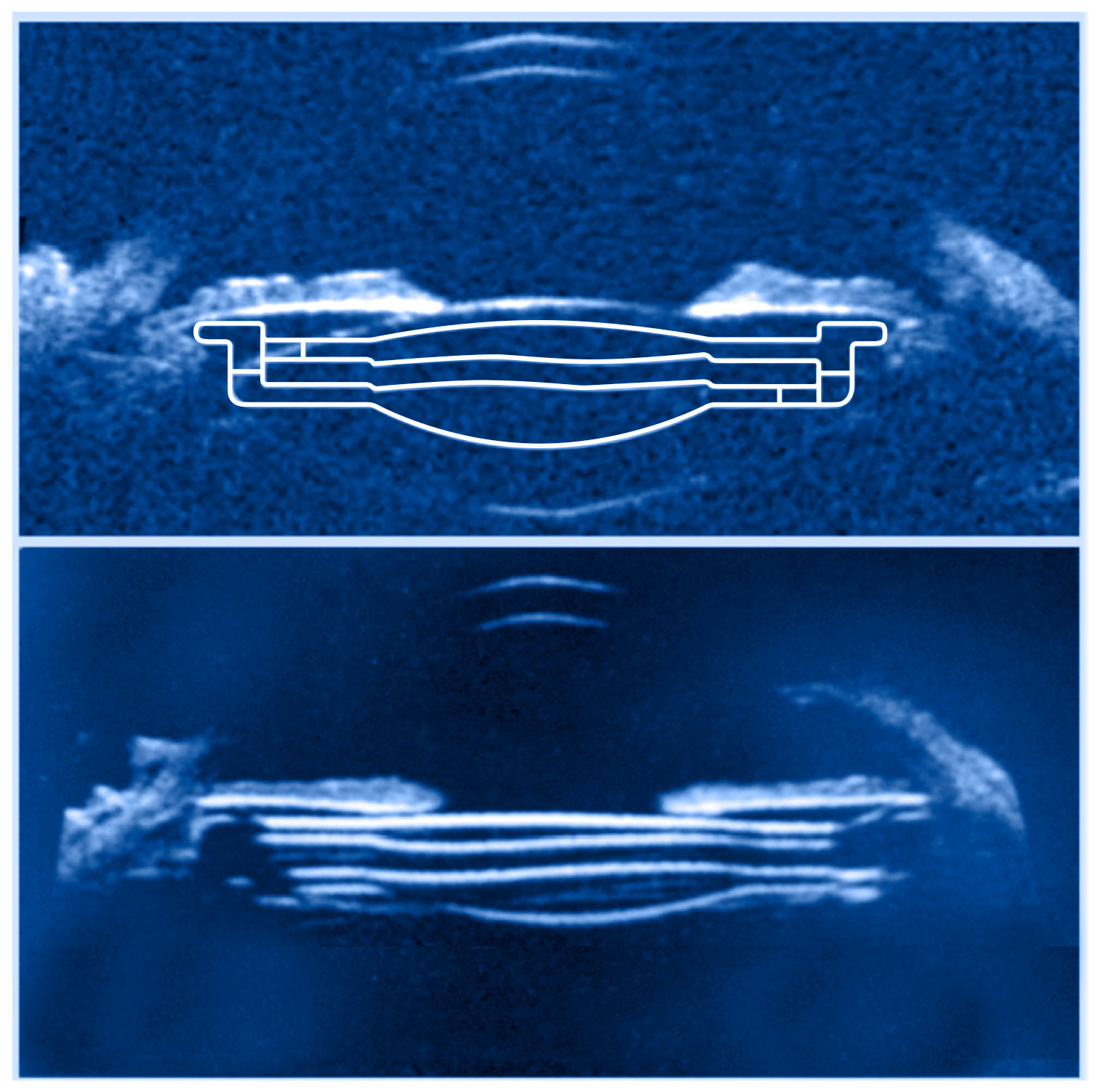 Lens-principle-04
